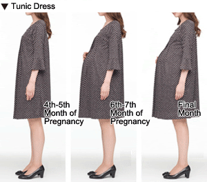 Tunic Dress